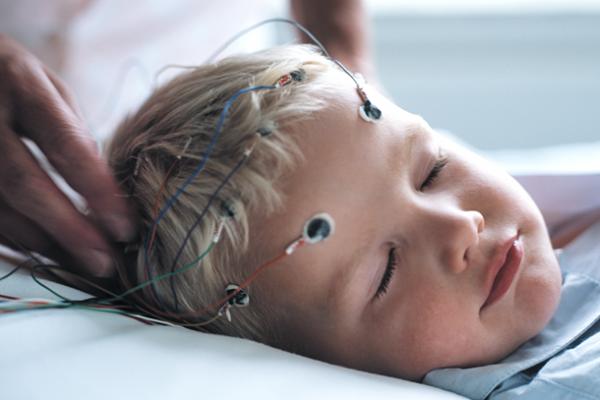 Electroencephalography EEG