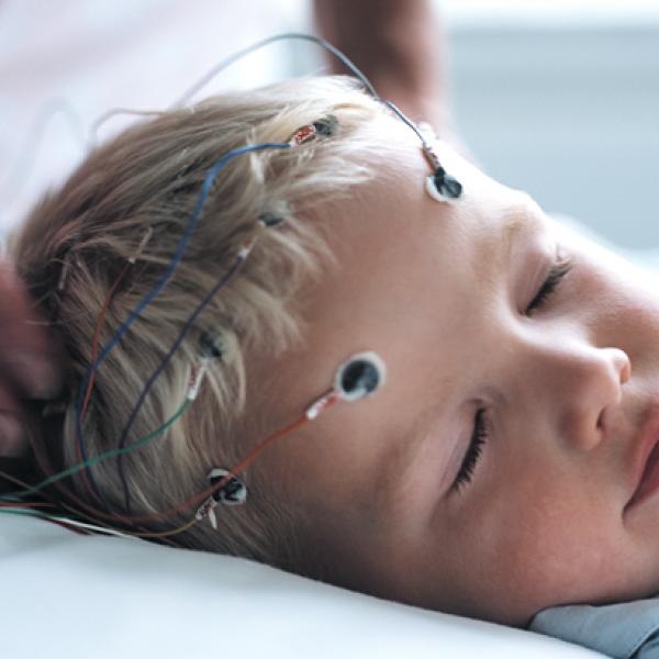 Electroencephalography EEG